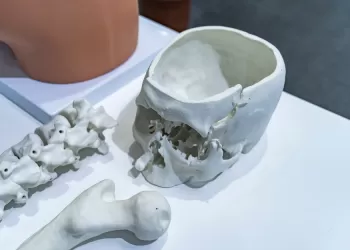 3D Baskı ile Organ Üretimi